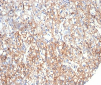 Fibrillin-1 (FBN1) (Marfan Syndrome Marker) Antibody in Immunohistochemistry (Paraffin) (IHC (P))
