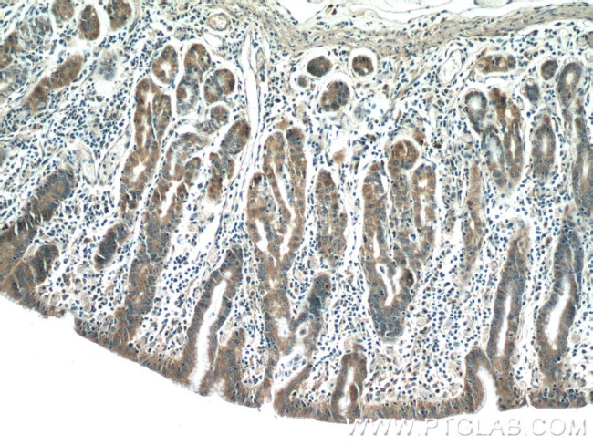 NFATC2 Antibody in Immunohistochemistry (Paraffin) (IHC (P))