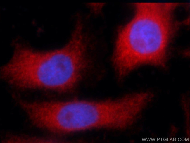 ARPC5L Antibody in Immunocytochemistry (ICC/IF)