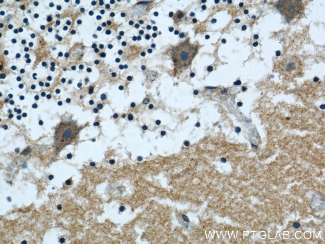 ARPC5L Antibody in Immunohistochemistry (Paraffin) (IHC (P))