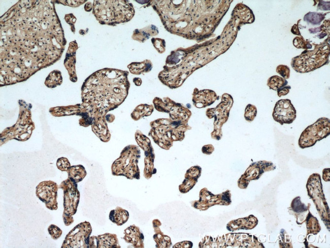 ARPC5L Antibody in Immunohistochemistry (Paraffin) (IHC (P))