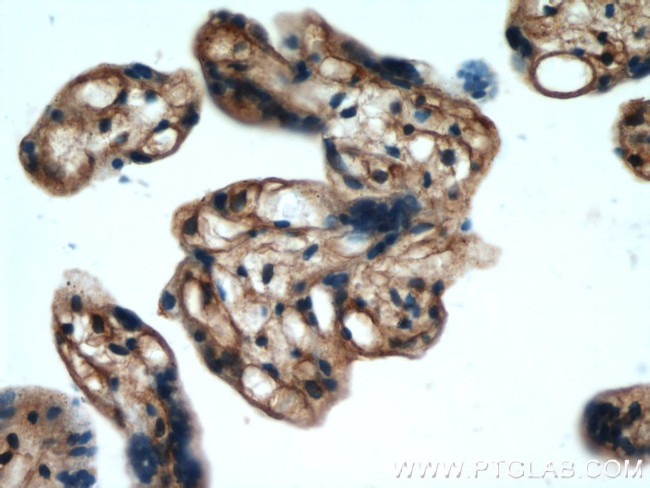 ARPC5L Antibody in Immunohistochemistry (Paraffin) (IHC (P))