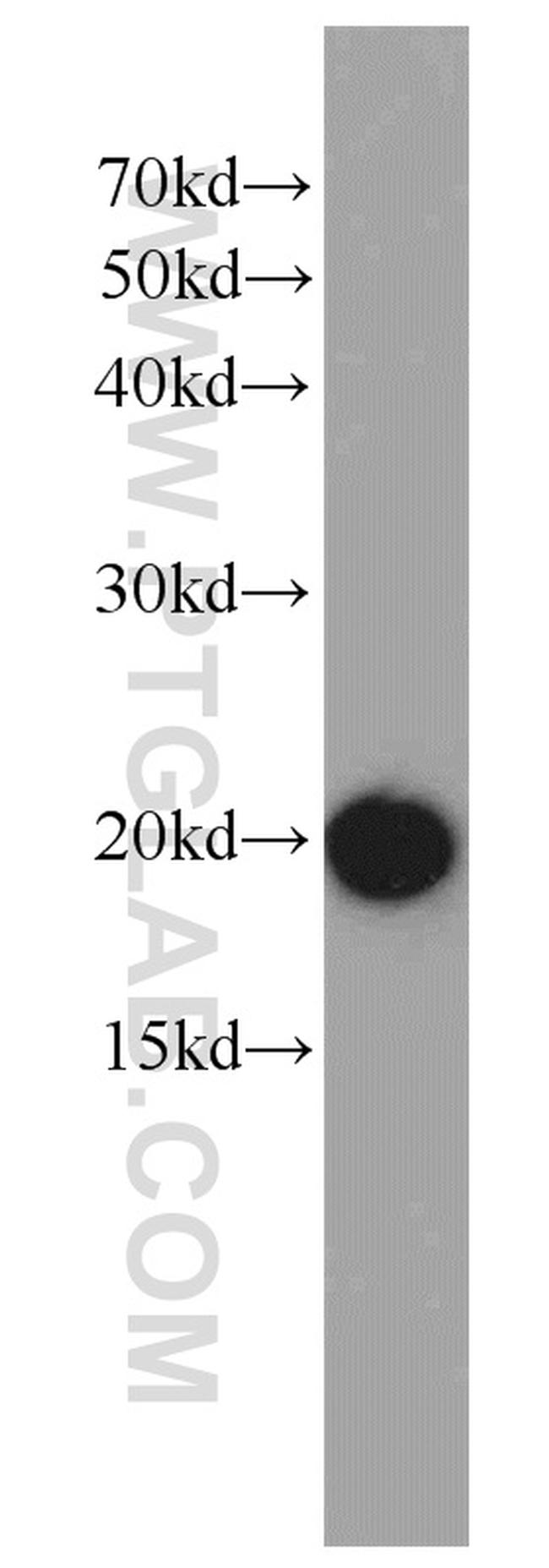 ARPC5L Antibody in Western Blot (WB)