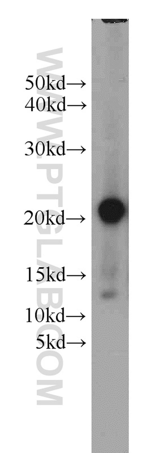 ARPC5L Antibody in Western Blot (WB)