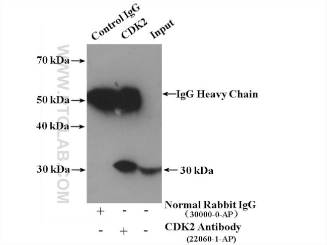 CDK2 Antibody in Immunoprecipitation (IP)