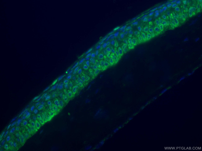 PDE6B Antibody in Immunohistochemistry (PFA fixed) (IHC (PFA))