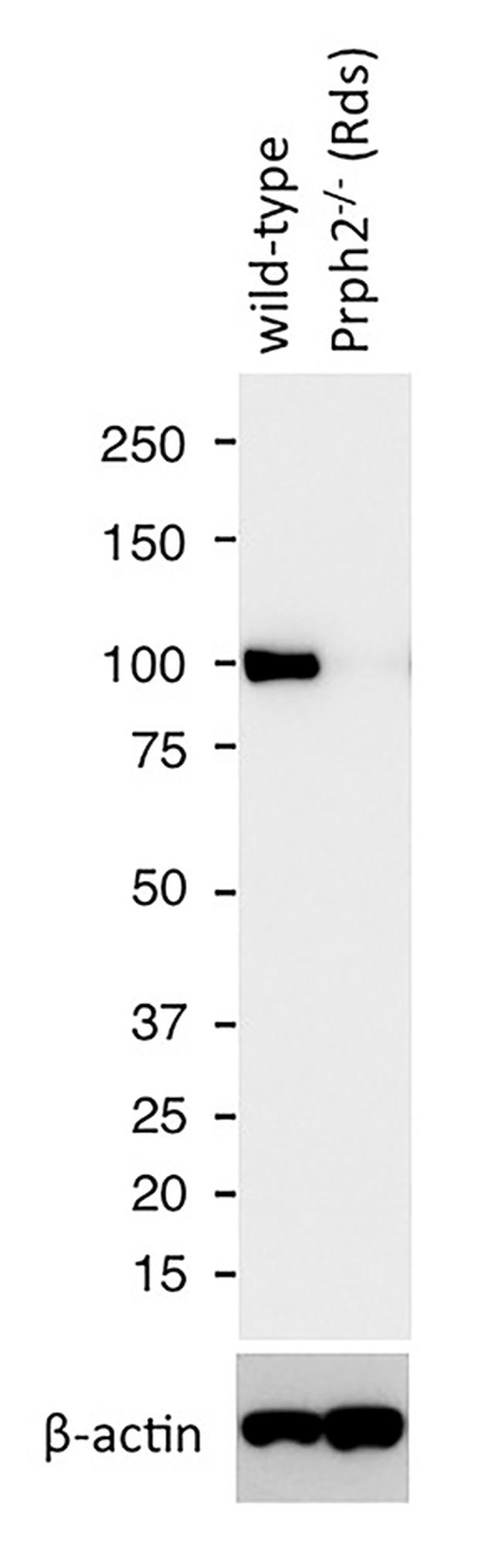 PDE6B Antibody in Western Blot (WB)