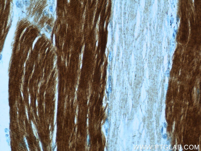 TNNI2 Antibody in Immunohistochemistry (Paraffin) (IHC (P))