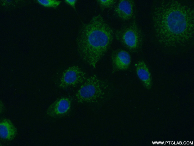 FUT4 Antibody in Immunocytochemistry (ICC/IF)