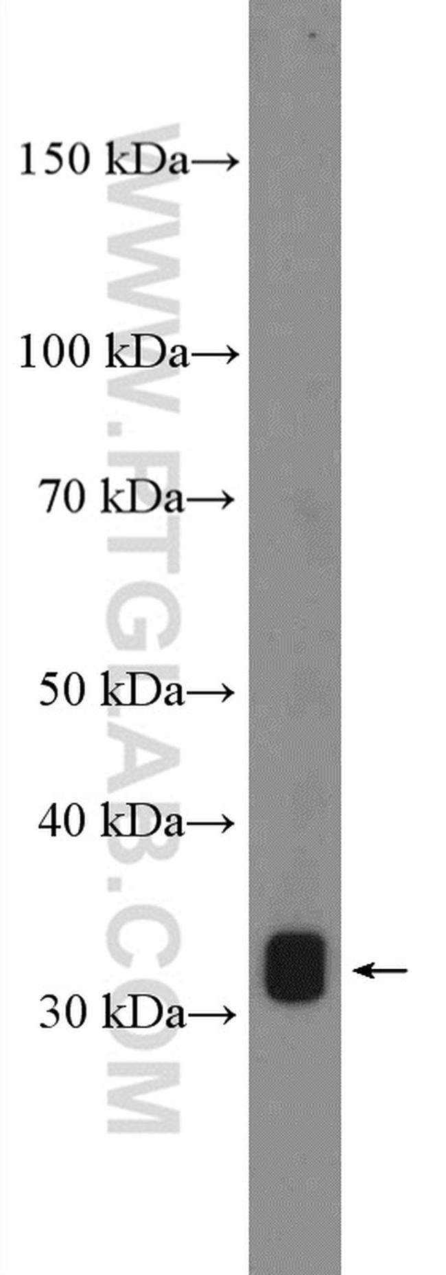 PRB3 Antibody in Western Blot (WB)