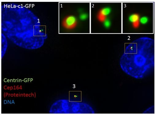 CEP164 Antibody in Immunocytochemistry (ICC/IF)