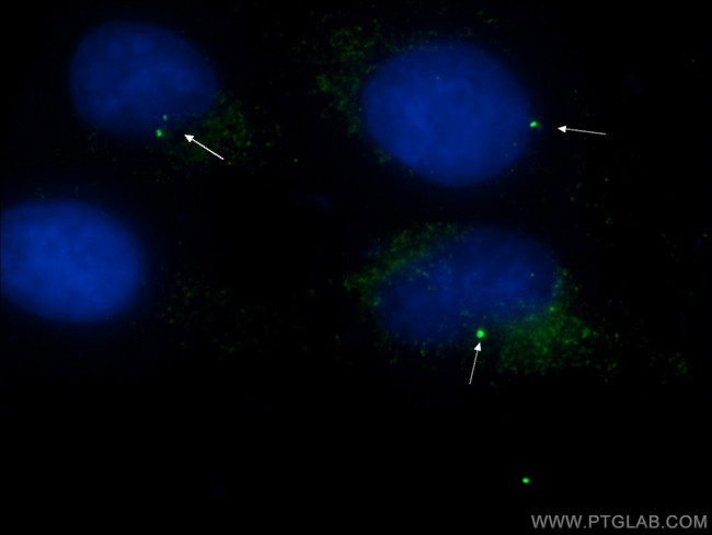 CEP164 Antibody in Immunocytochemistry (ICC/IF)