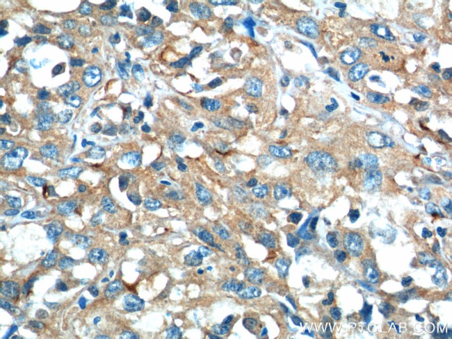 CEP164 Antibody in Immunohistochemistry (Paraffin) (IHC (P))