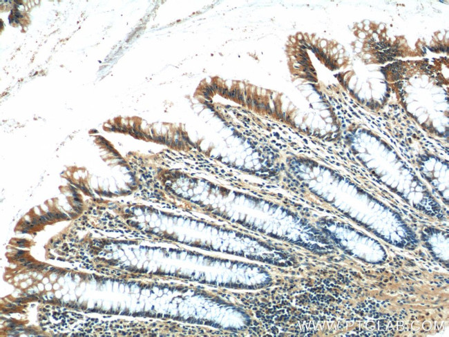 CEP164 Antibody in Immunohistochemistry (Paraffin) (IHC (P))