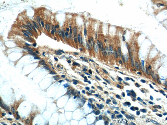 CEP164 Antibody in Immunohistochemistry (Paraffin) (IHC (P))