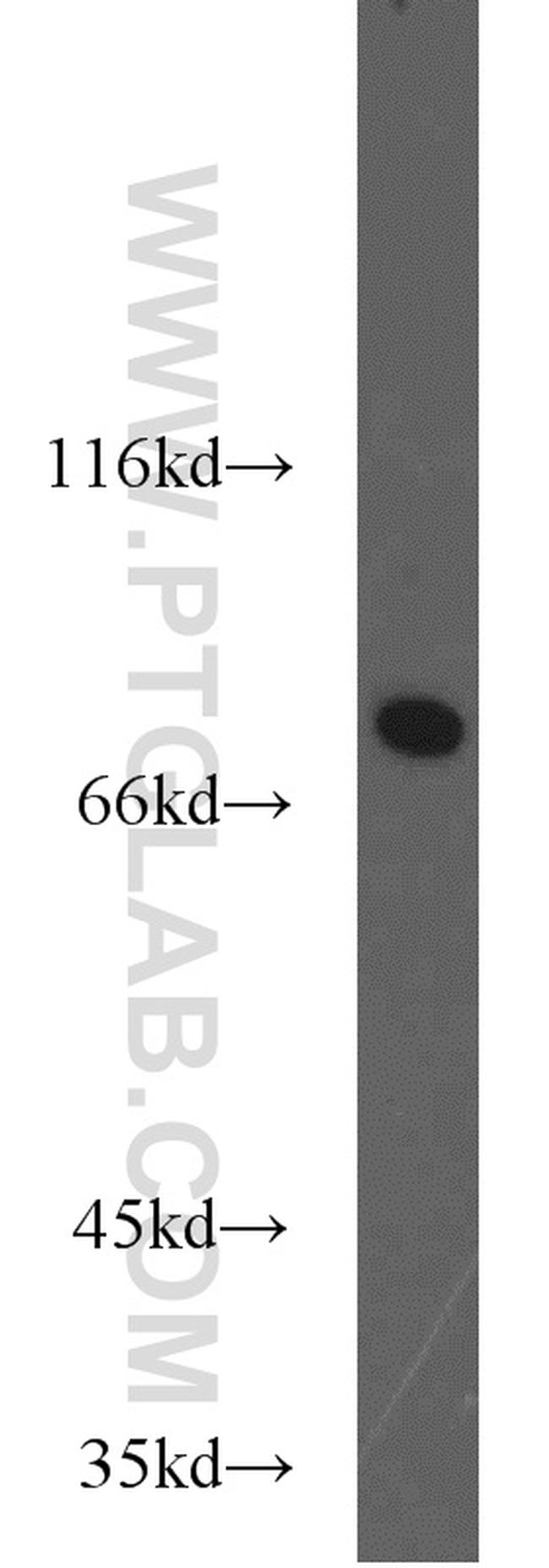 ADARB1 Antibody in Western Blot (WB)
