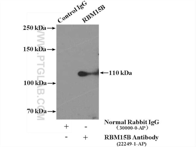 RBM15B Antibody in Immunoprecipitation (IP)