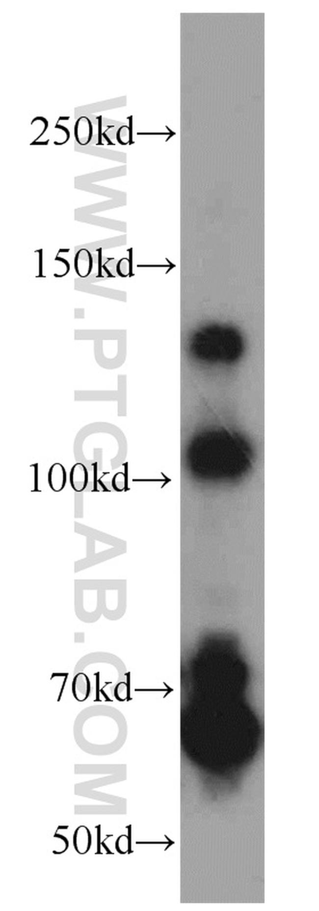 RBM15B Antibody in Western Blot (WB)