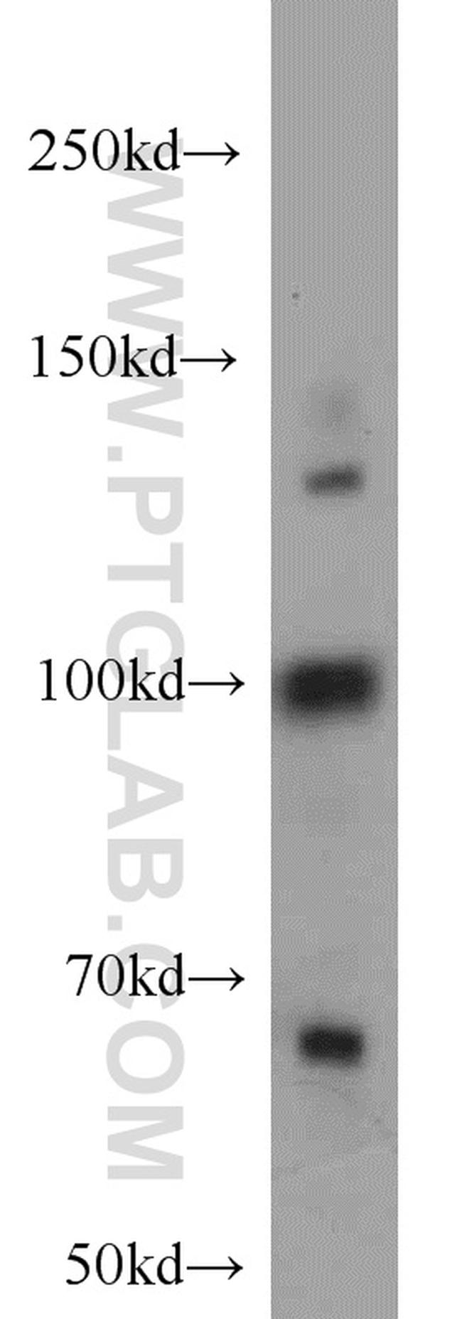 RBM15B Antibody in Western Blot (WB)