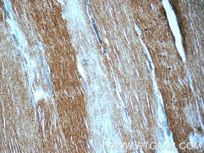 MYH1-internal Antibody in Immunohistochemistry (Paraffin) (IHC (P))