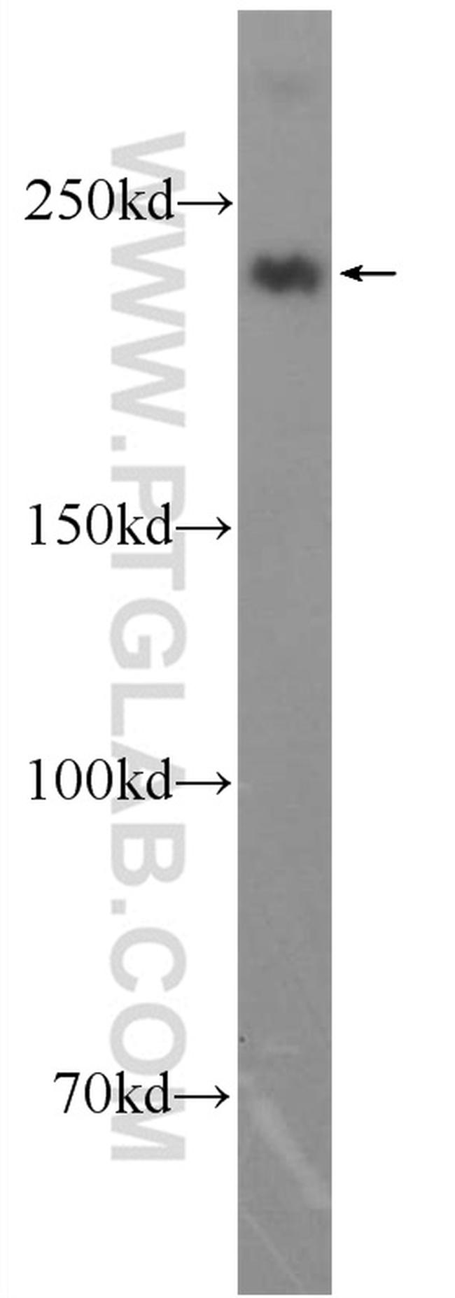 MYH1-internal Antibody in Western Blot (WB)