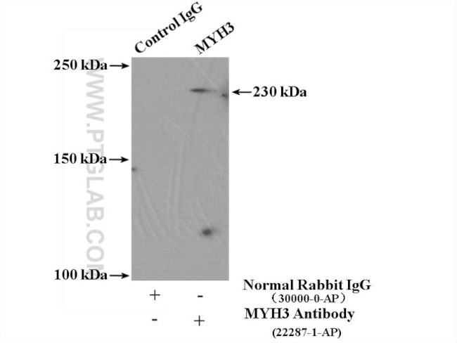 MYH3 Antibody in Immunoprecipitation (IP)