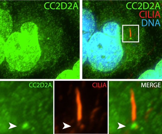 CC2D2A Antibody in Immunocytochemistry (ICC/IF)