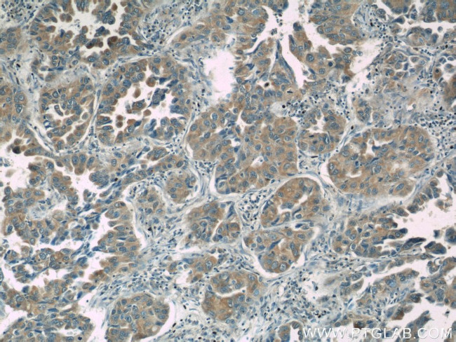 CC2D2A Antibody in Immunohistochemistry (Paraffin) (IHC (P))