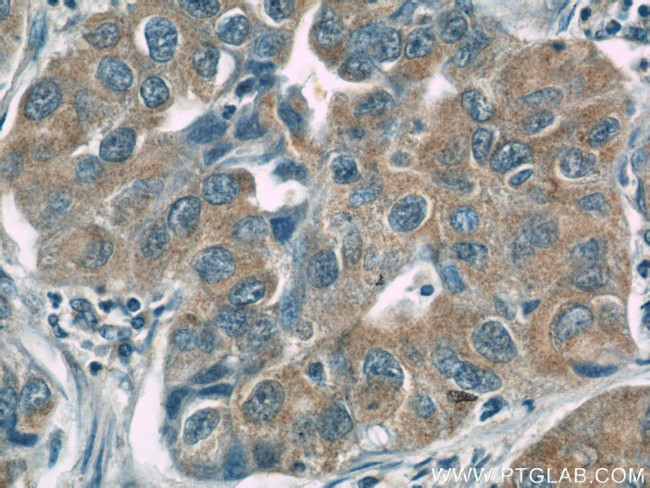 CC2D2A Antibody in Immunohistochemistry (Paraffin) (IHC (P))