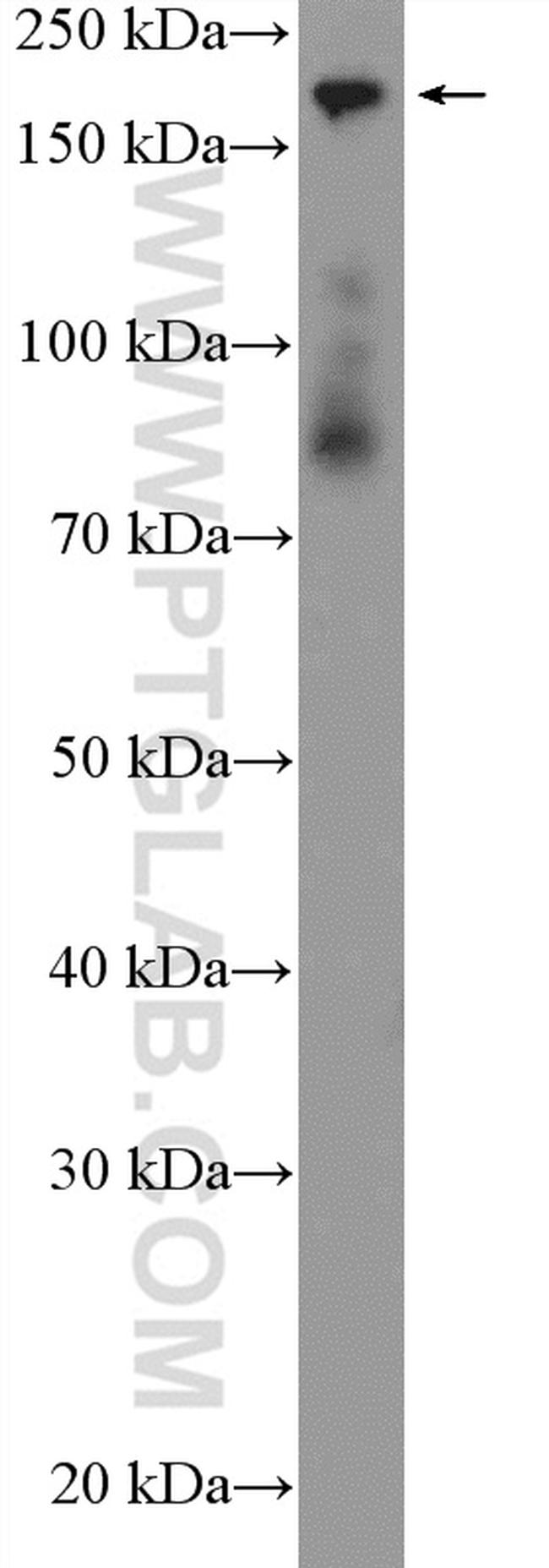 CC2D2A Antibody in Western Blot (WB)