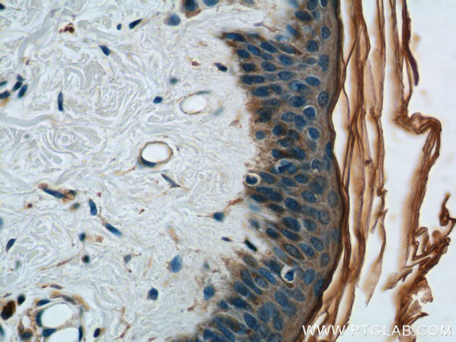 TGF-alpha Antibody in Immunohistochemistry (Paraffin) (IHC (P))