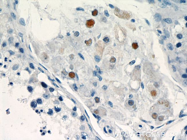 TCF4 Antibody in Immunohistochemistry (Paraffin) (IHC (P))