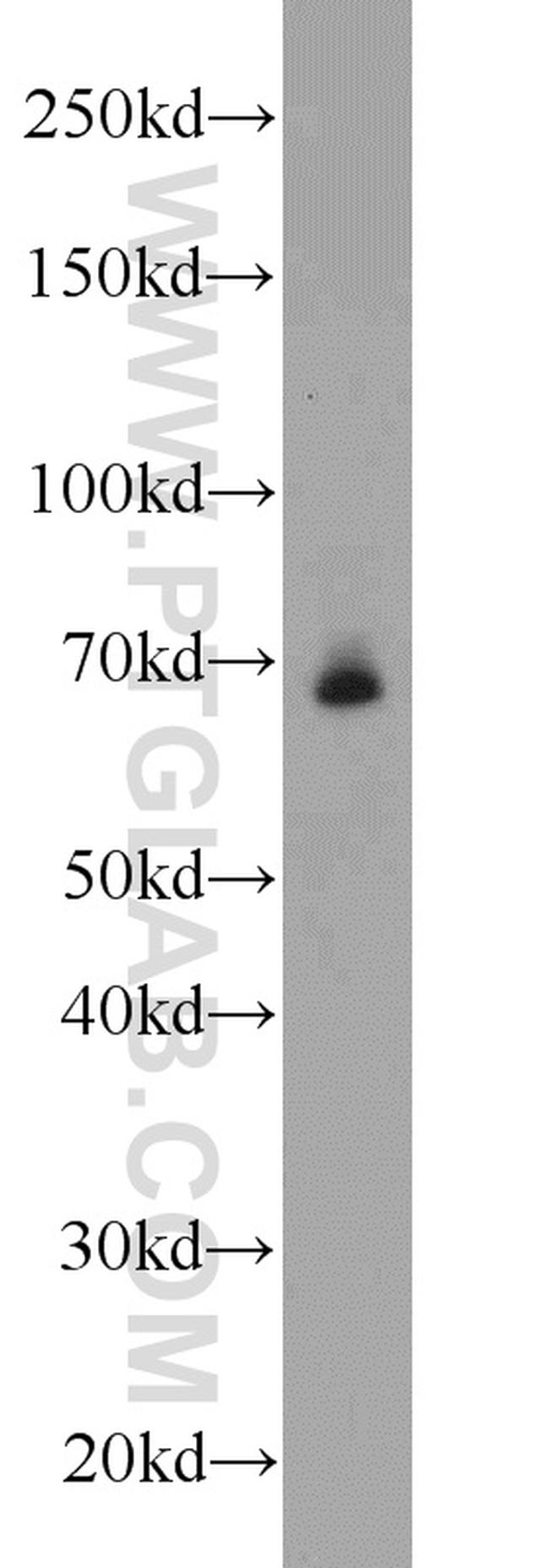 TCF4 Antibody in Western Blot (WB)