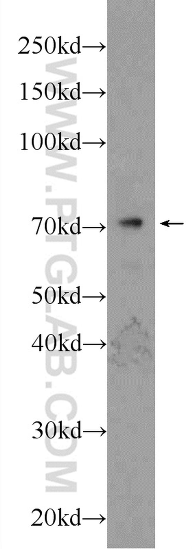 TCF4 Antibody in Western Blot (WB)