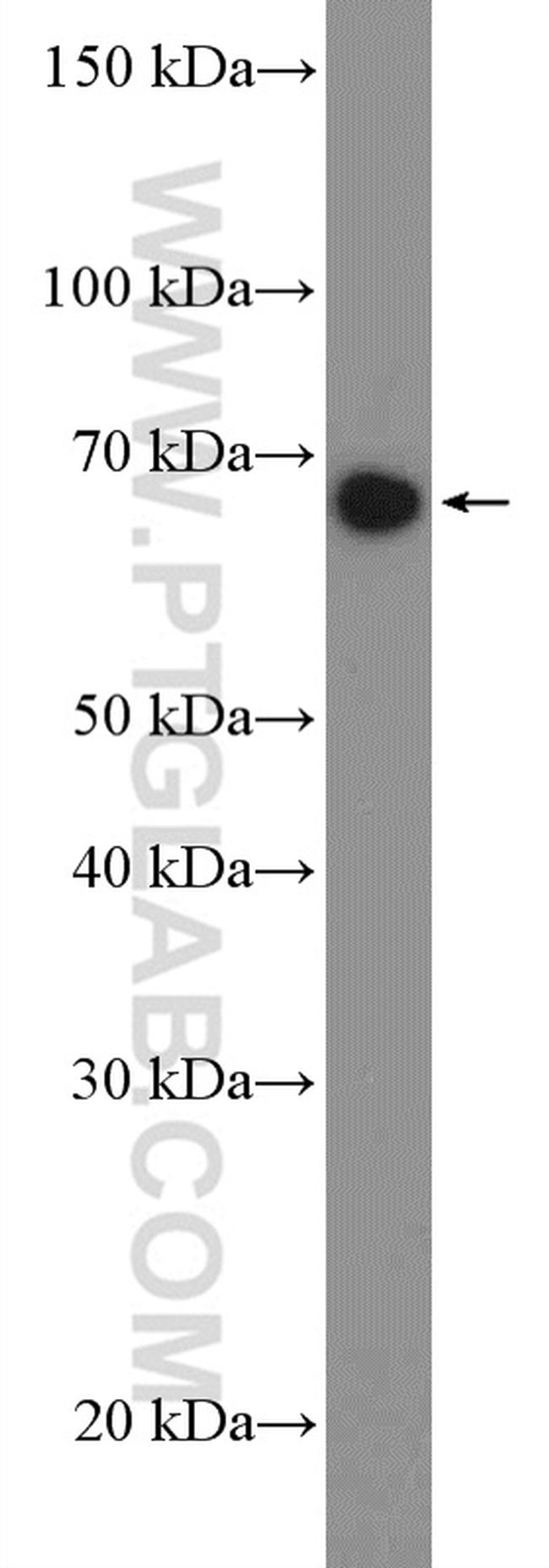 TCF4 Antibody in Western Blot (WB)