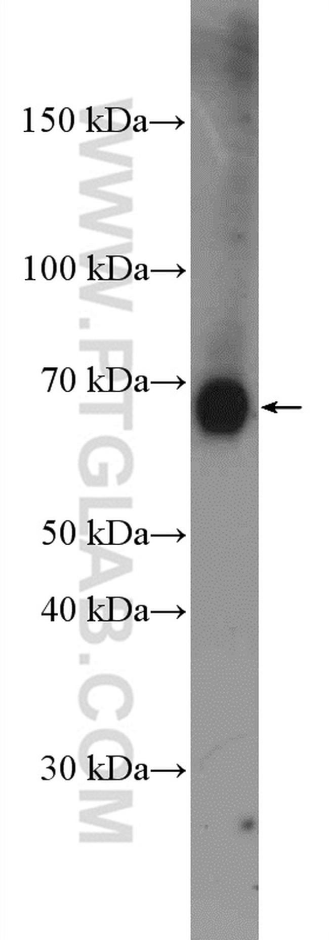 TCF4 Antibody in Western Blot (WB)