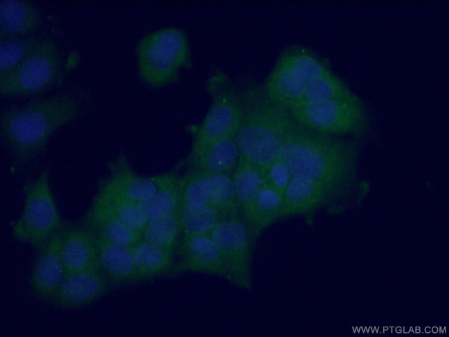 L-VEGFA Antibody in Immunocytochemistry (ICC/IF)