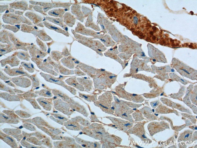 ATP2A1 Antibody in Immunohistochemistry (Paraffin) (IHC (P))