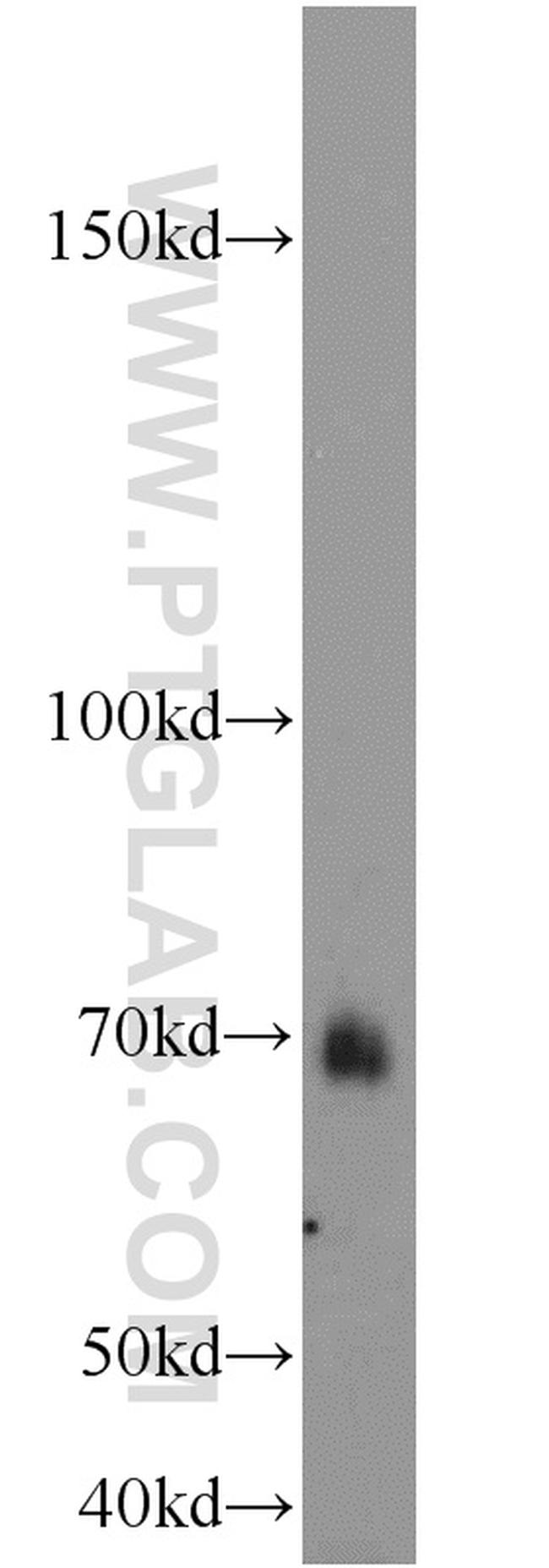 ADRA1B Antibody in Western Blot (WB)