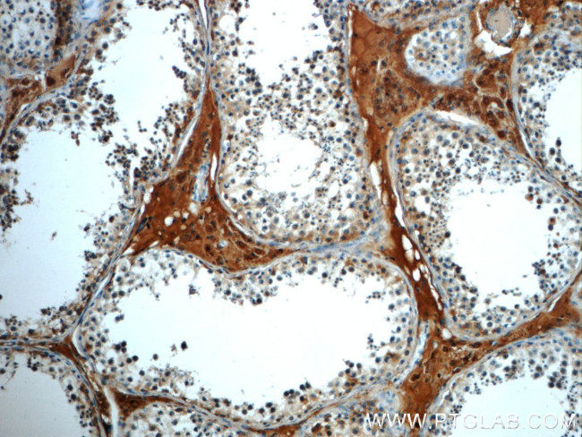 C4orf49 Antibody in Immunohistochemistry (Paraffin) (IHC (P))