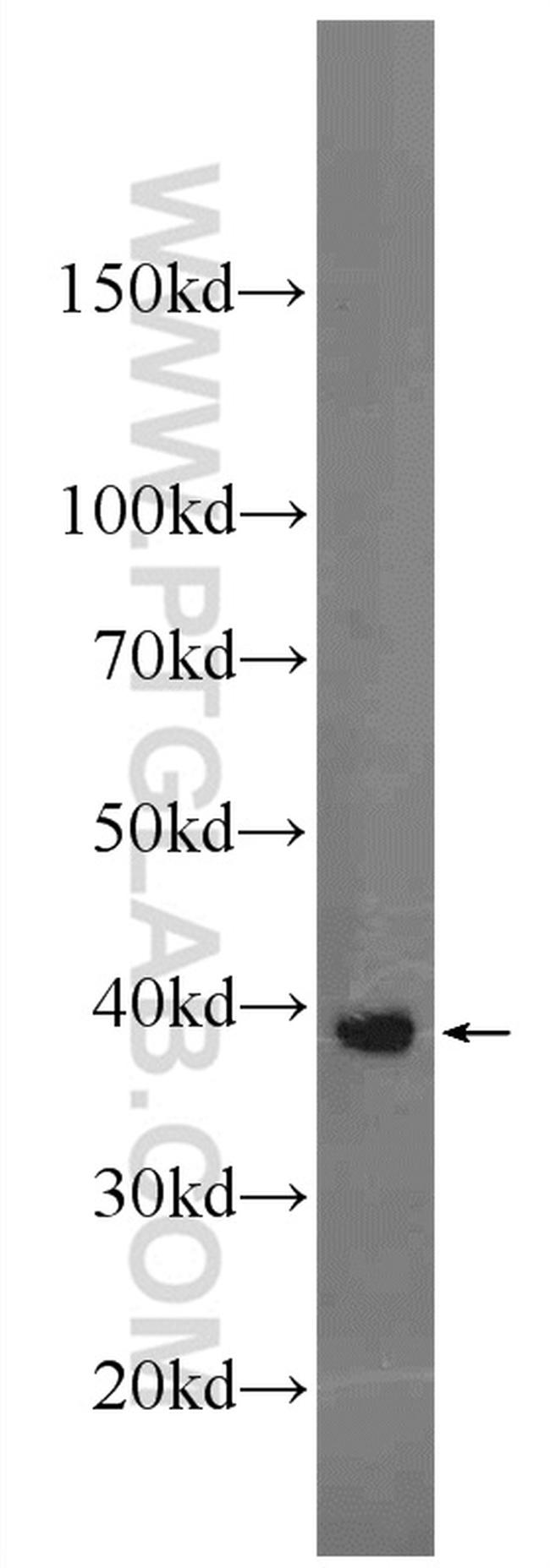 C4orf49 Antibody in Western Blot (WB)