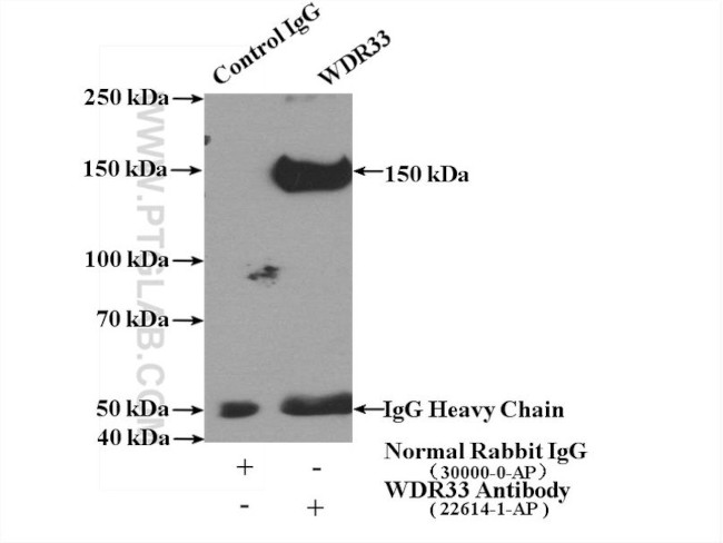 WDR33 Antibody in Immunoprecipitation (IP)