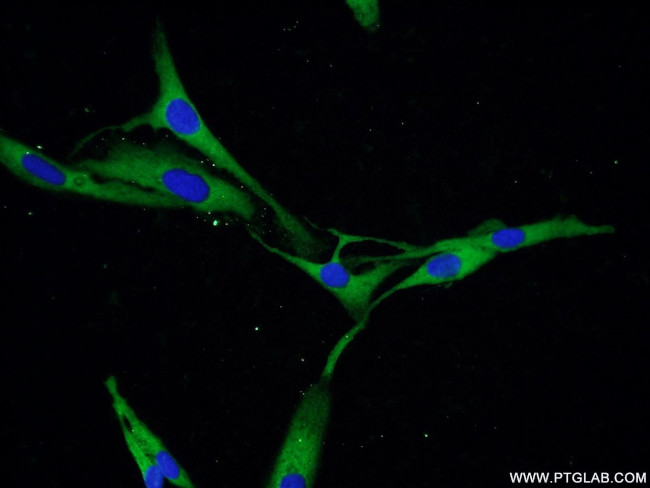 PDE5A Antibody in Immunocytochemistry (ICC/IF)