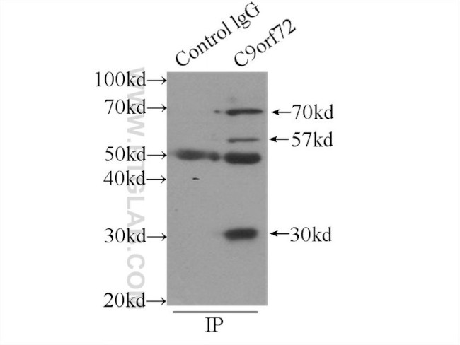 C9orf72 Antibody in Immunoprecipitation (IP)