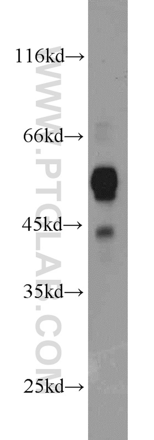 C9orf72 Antibody in Western Blot (WB)