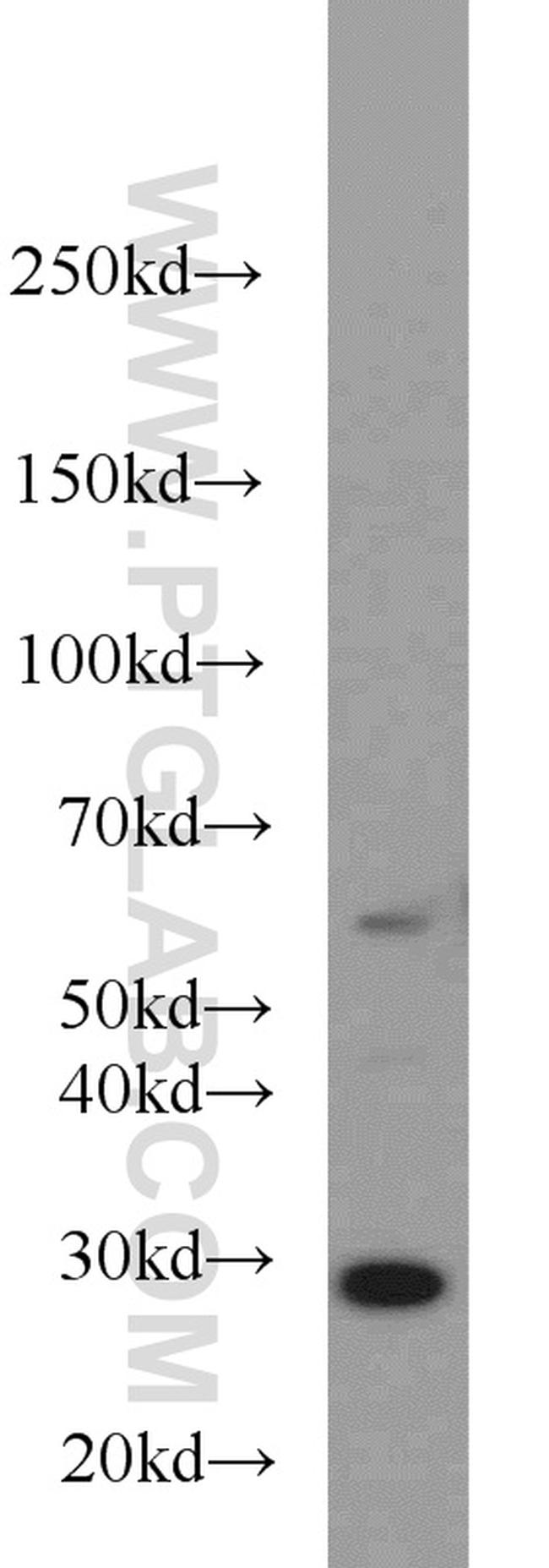 C9orf72 Antibody in Western Blot (WB)