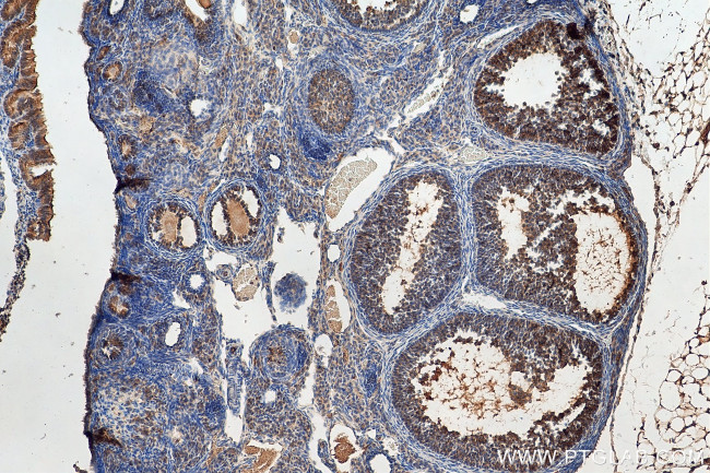 FSHR Antibody in Immunohistochemistry (Paraffin) (IHC (P))