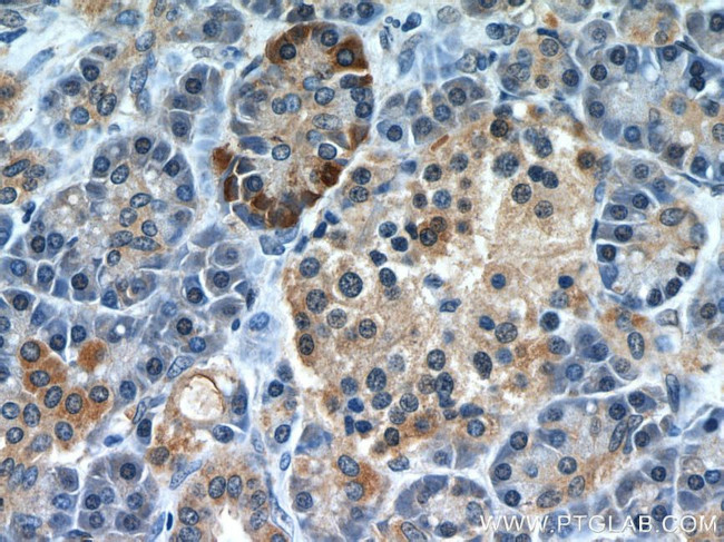 A4GNT Antibody in Immunohistochemistry (Paraffin) (IHC (P))