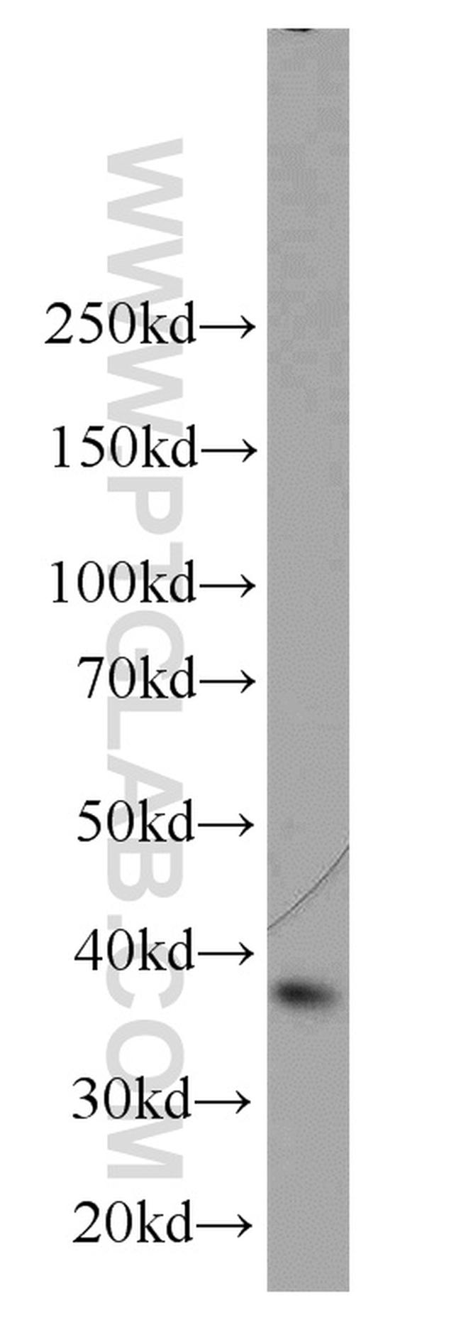 A4GNT Antibody in Western Blot (WB)