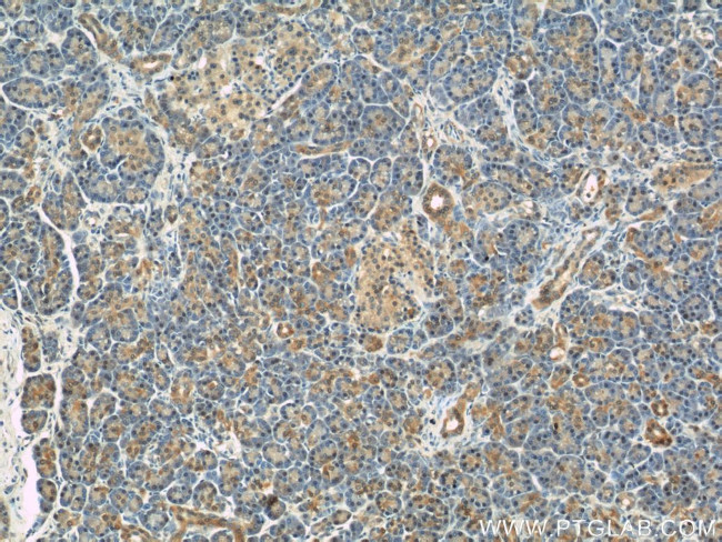 RBP1 Antibody in Immunohistochemistry (Paraffin) (IHC (P))